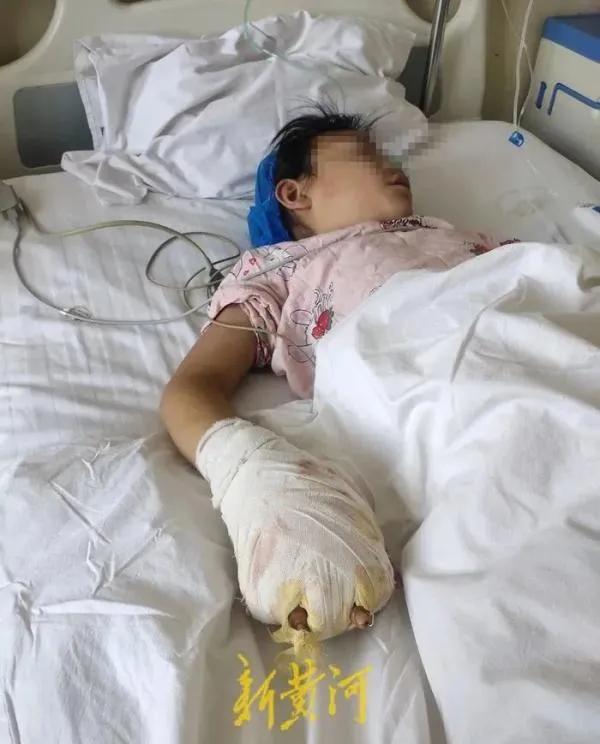 恶毒母亲开水烫伤5岁女孩,甘肃4岁女童被继母虐待事件后续