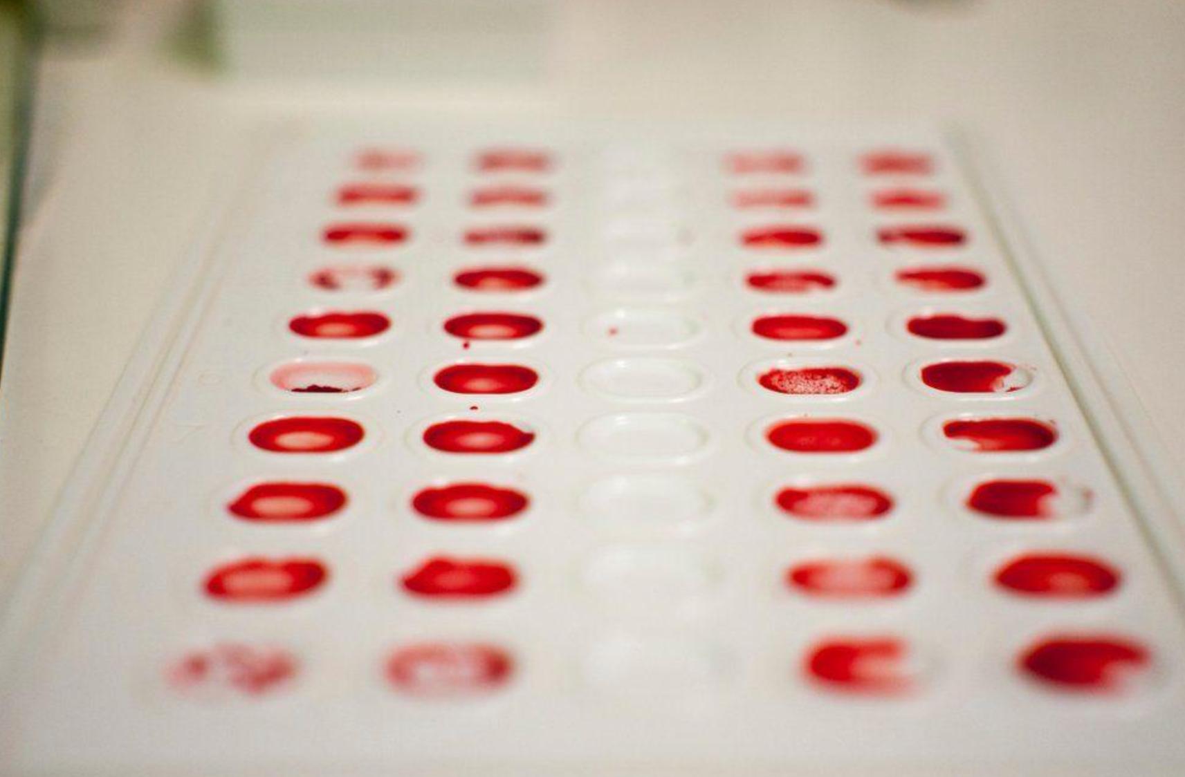 比熊猫血还稀有,比熊猫血还罕见的血