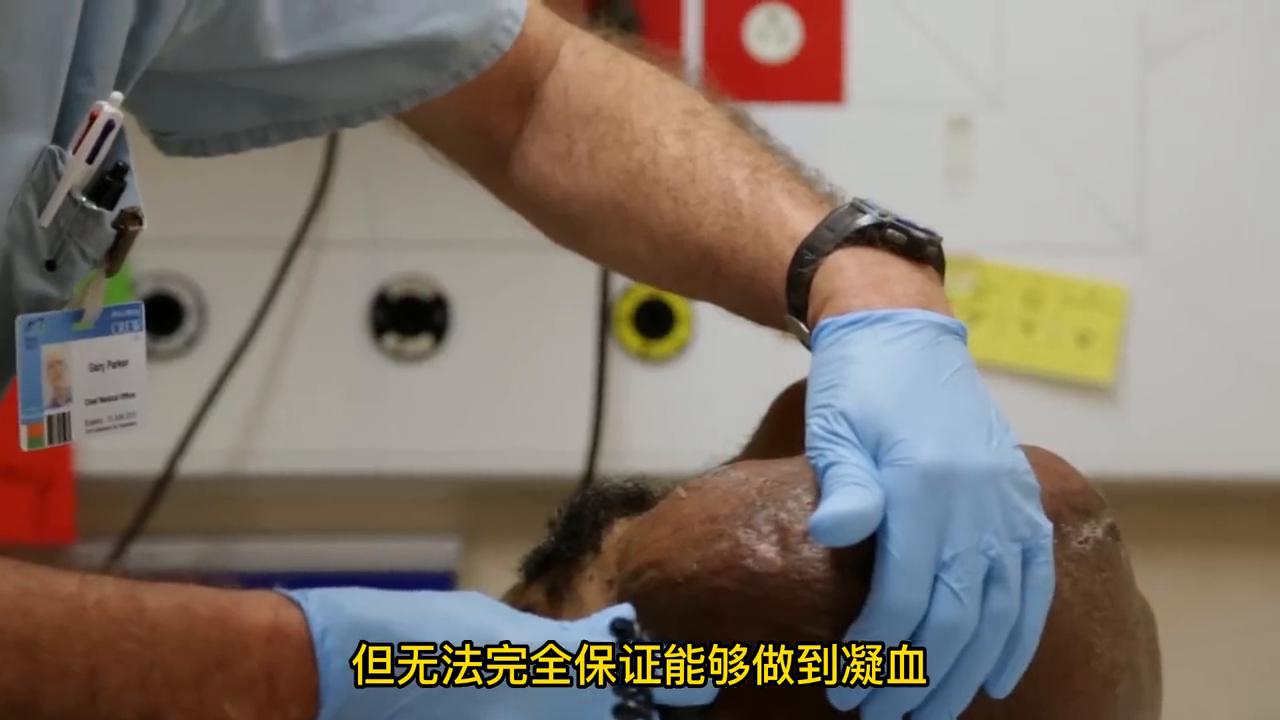 全身长满肿瘤男人后续,男子全身长肿瘤