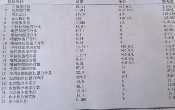 白细胞增多是病吗,白细胞增多就是白血病吗