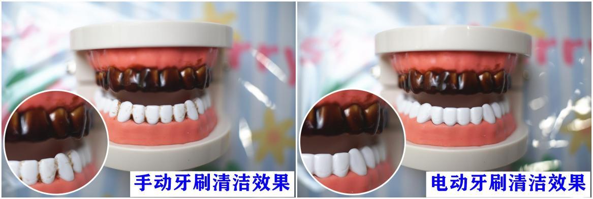 儿童电动牙刷会对牙齿不好吗,儿童电动牙刷会伤害牙齿吗