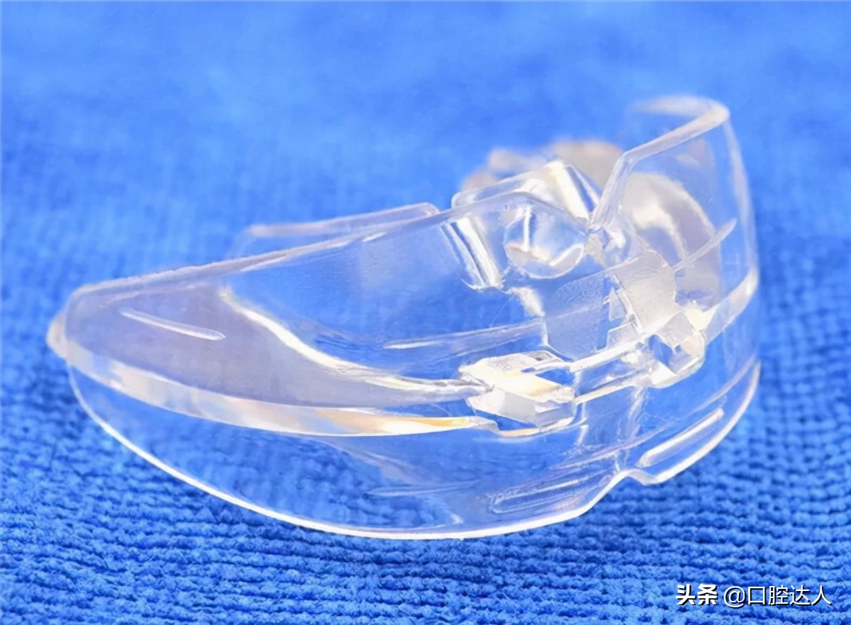 打骨钉改善露龈笑多久能看到效果,露龈笑是天生的吗