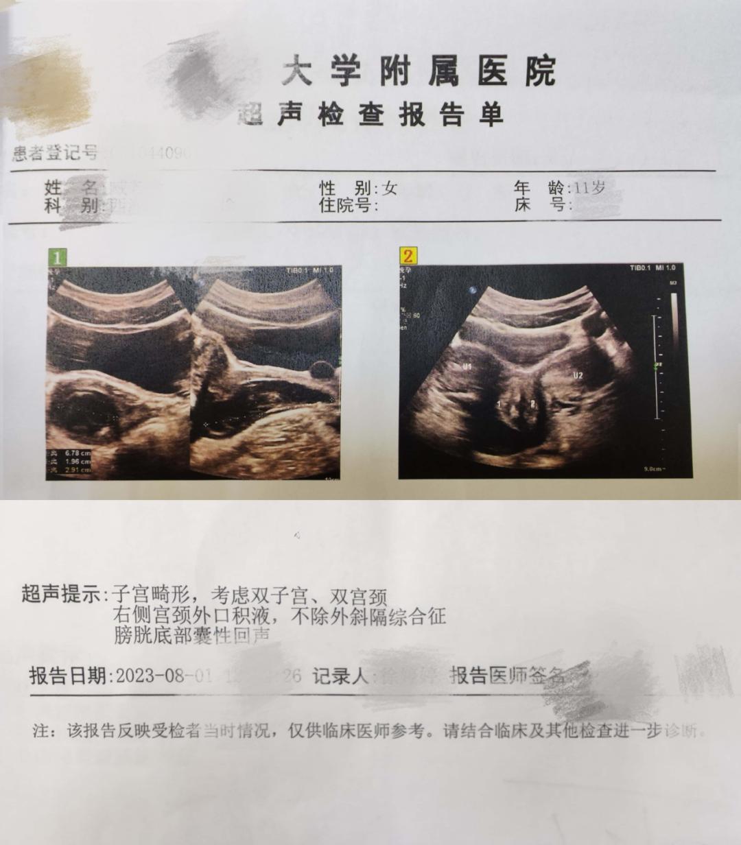 小肚子疼尿血小孩,青春期女孩出血