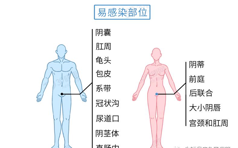 怎么确定自己是否感染尖锐湿疣,如何确认感染尖锐性湿疣