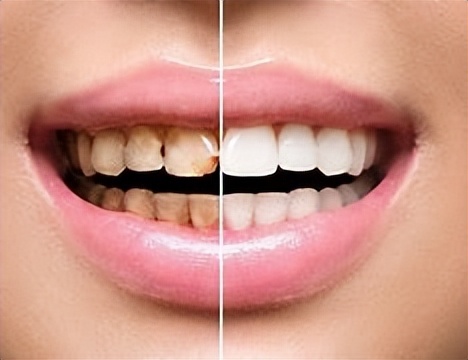 实用生活小窍门100个妙招,生活小窍门妙招大全集值得收藏