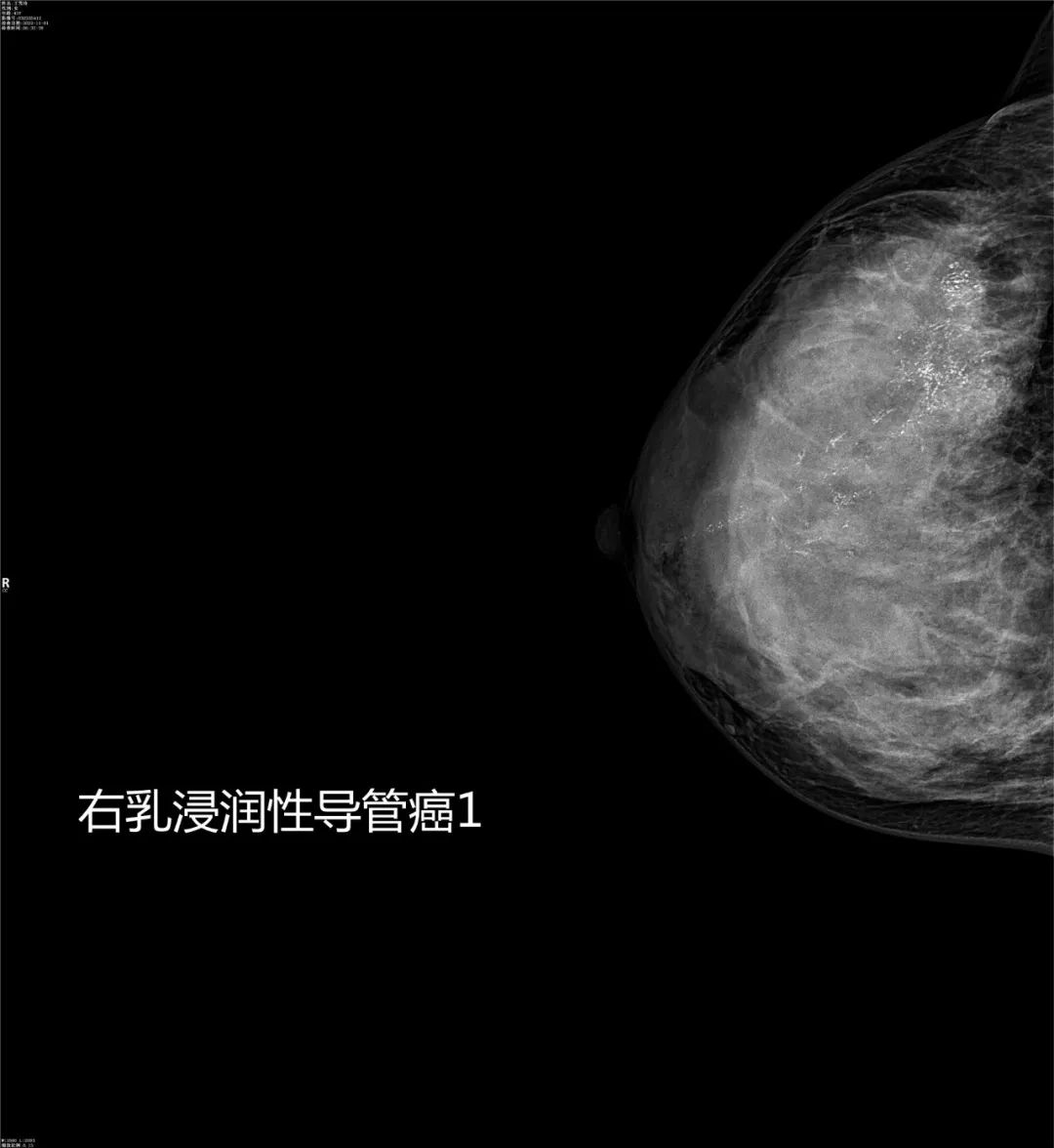 致敬公司的摄影师,美女致敬摄影师视频