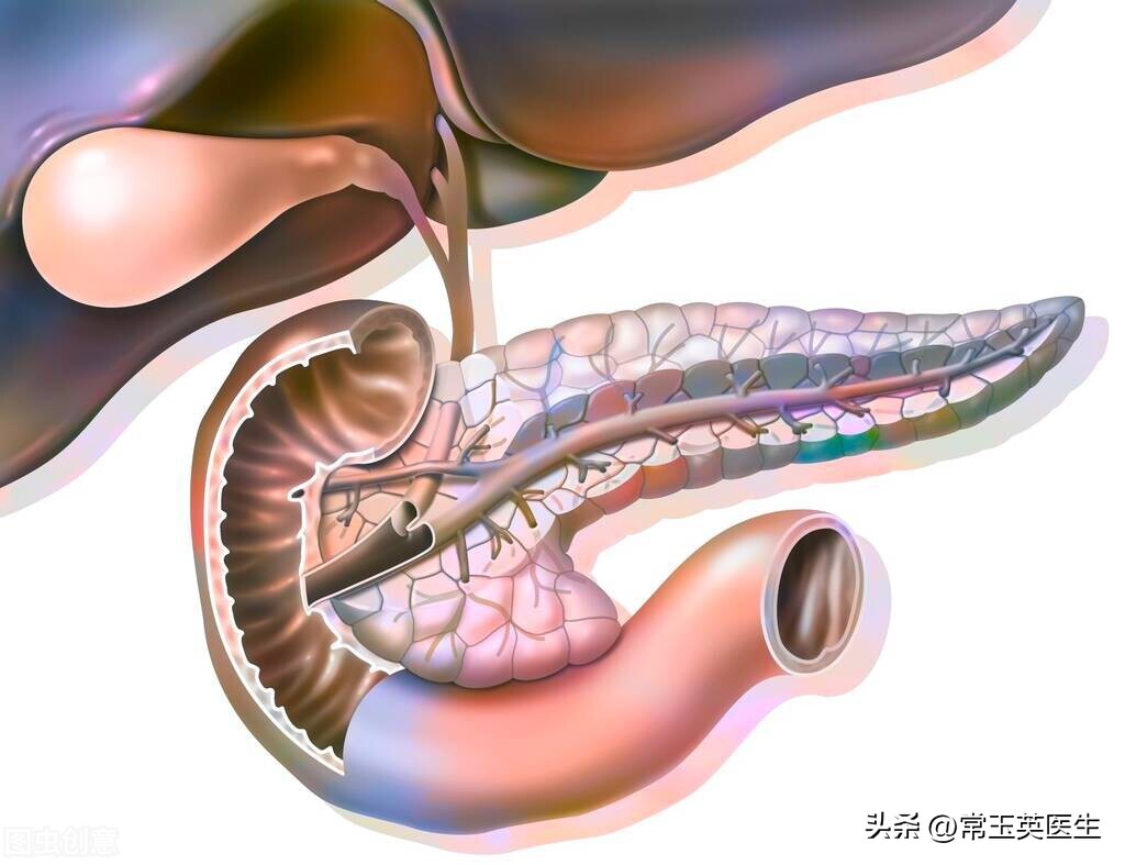 胆总管末端结石怎样处理才好,肝胆总管结石症状与危害