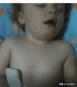 小儿支原体肺炎最佳治疗方法,小儿支原体肺炎治疗过程