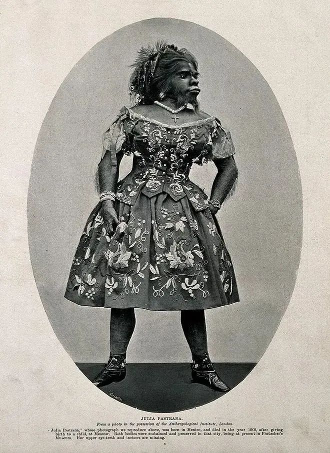 畸形秀背后的真相,畸形秀真实事件