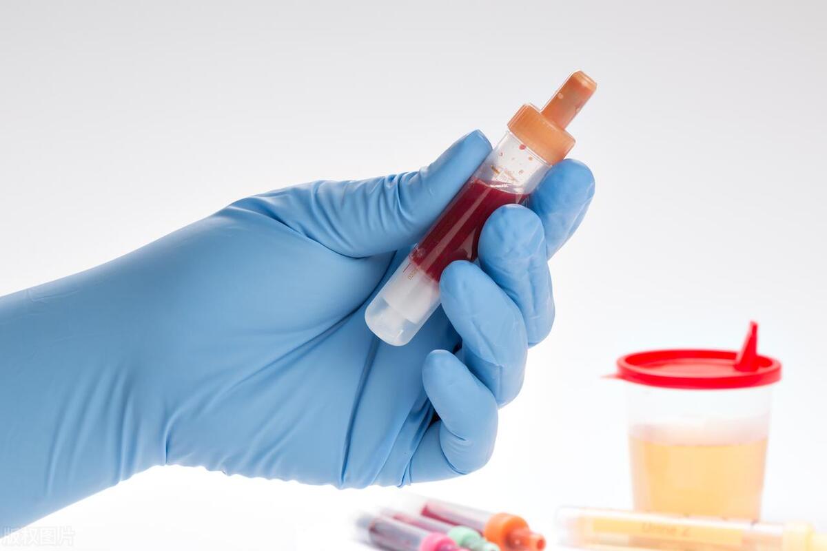 血尿是什么原因儿童,血尿是什么原因引起的女孩