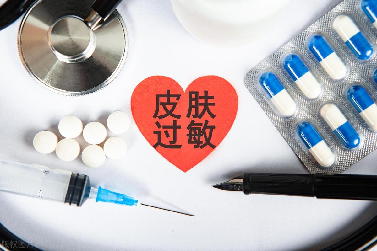 依巴斯汀降价,依巴斯汀停药后荨麻疹反弹