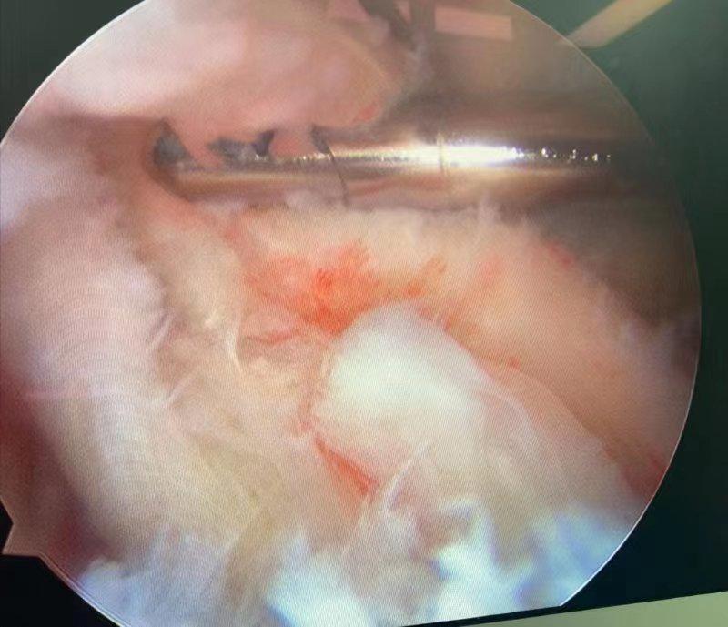 鑲╁叧鑺傚叧鑺傞暅寰垱浜茶韩缁忓巻,鑲╁叧鑺傚叧鑺傞暅瑙嗛