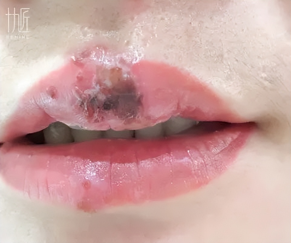 手工改乌唇全过程,改乌唇教程技巧