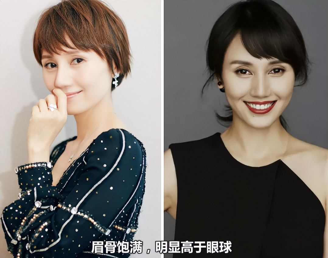 眼窝深邃和眼窝凹陷的区别,为什么眼窝凹陷眉骨颧骨都凸起