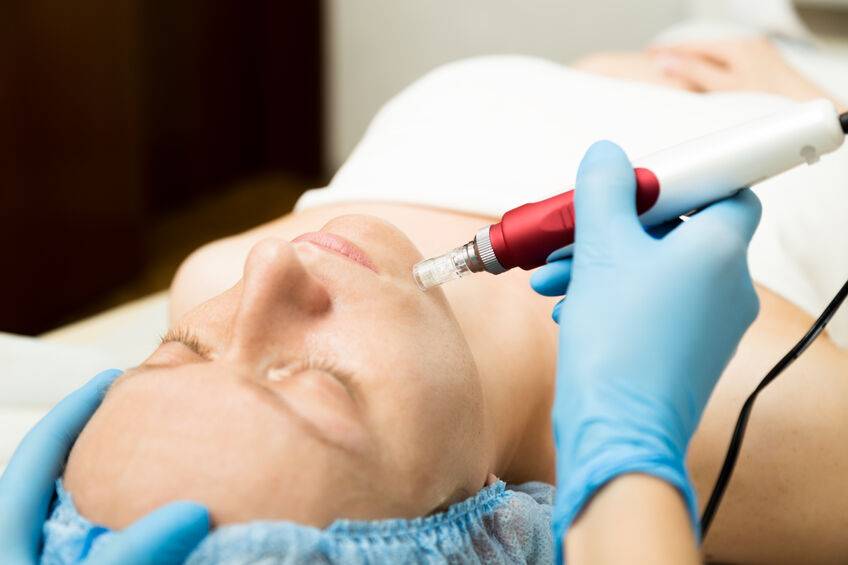 脸上老年斑有没有什么办法消除,脸上老年斑怎么消除最快方法