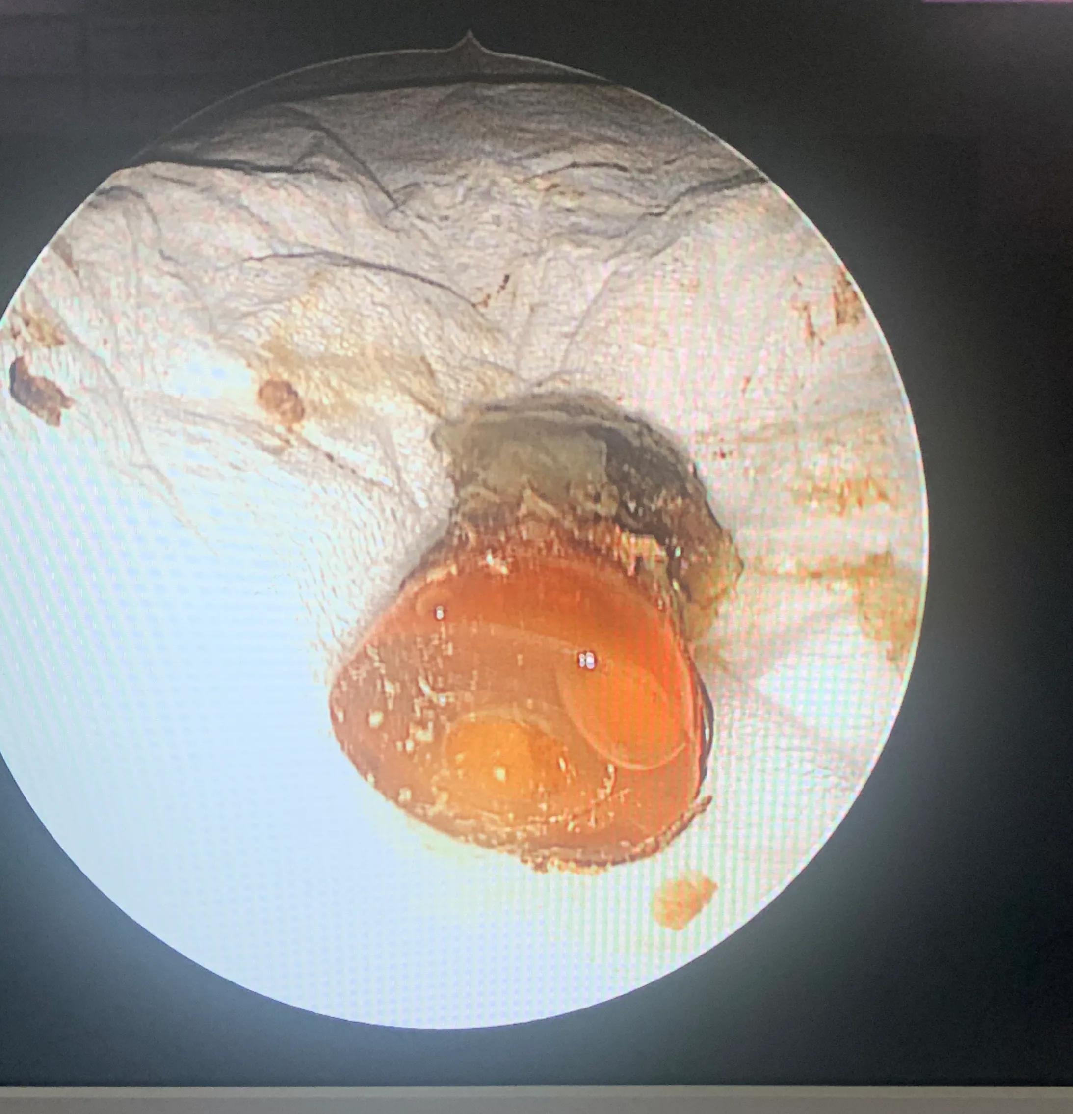 小东西解决大烦恼,小东西太多怎么解决