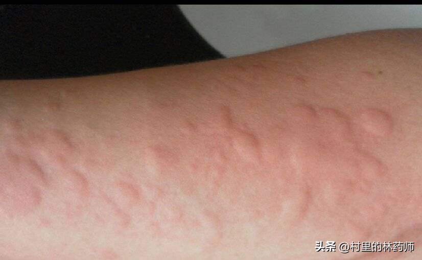 造影剂为什么是蓝色的,造影剂为什么有疏通作用