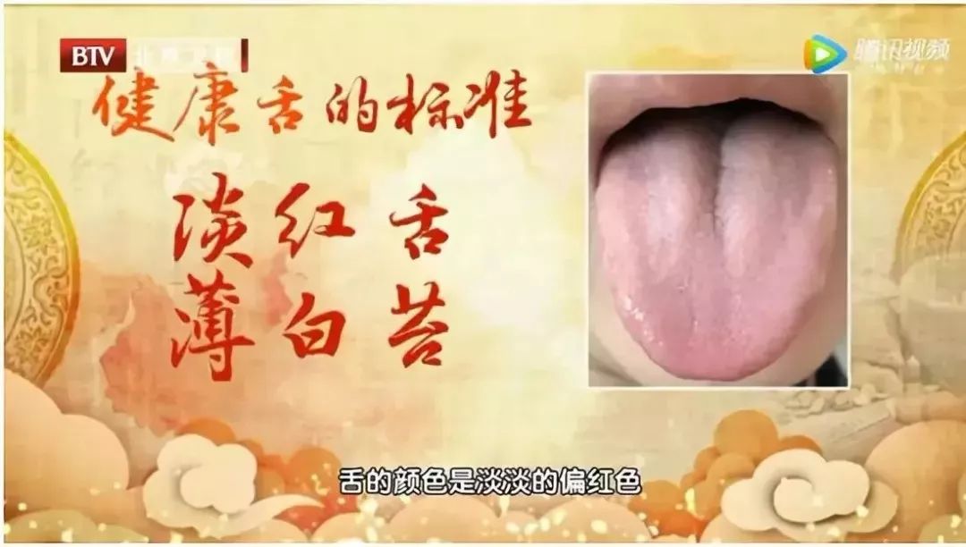 舌头出现这6个症状千万要警惕,舌头出现这24种症状