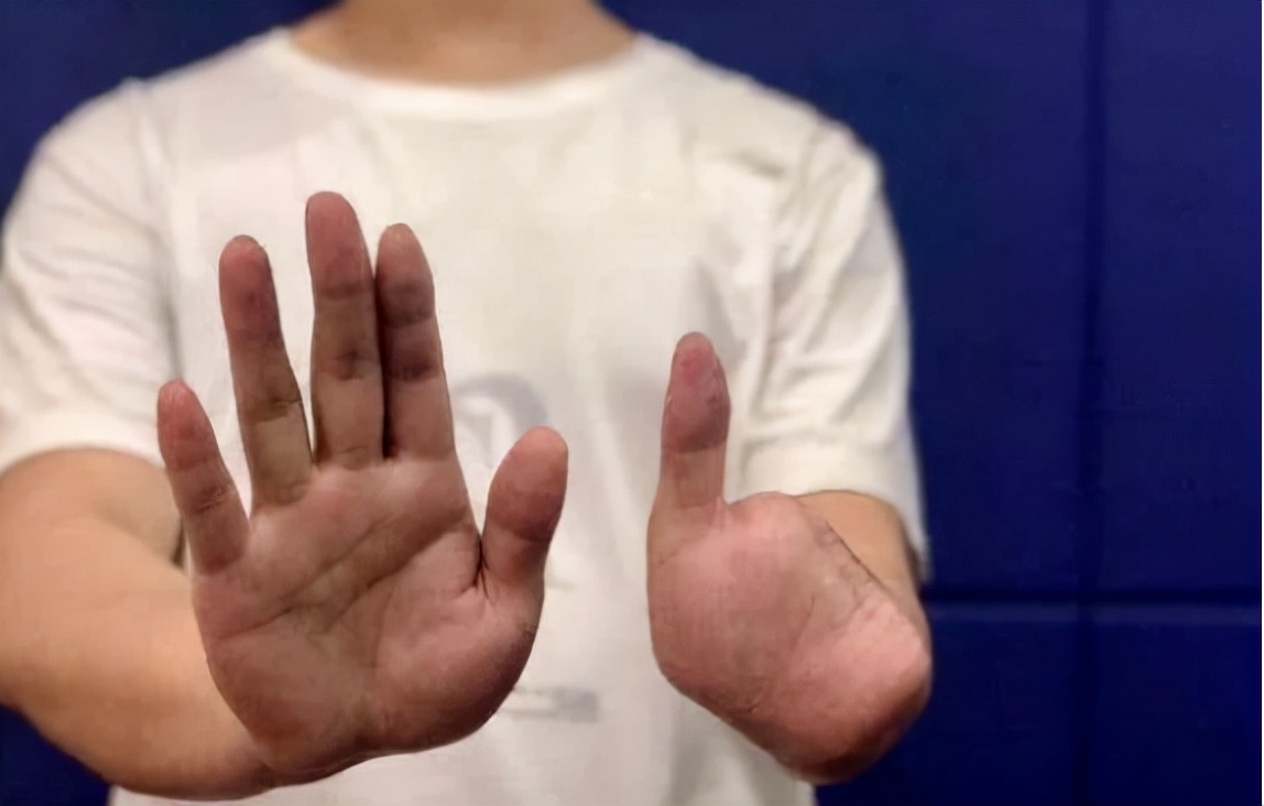 鱼泡网有哪些漏洞,怎么分辨鱼泡网的真假信息