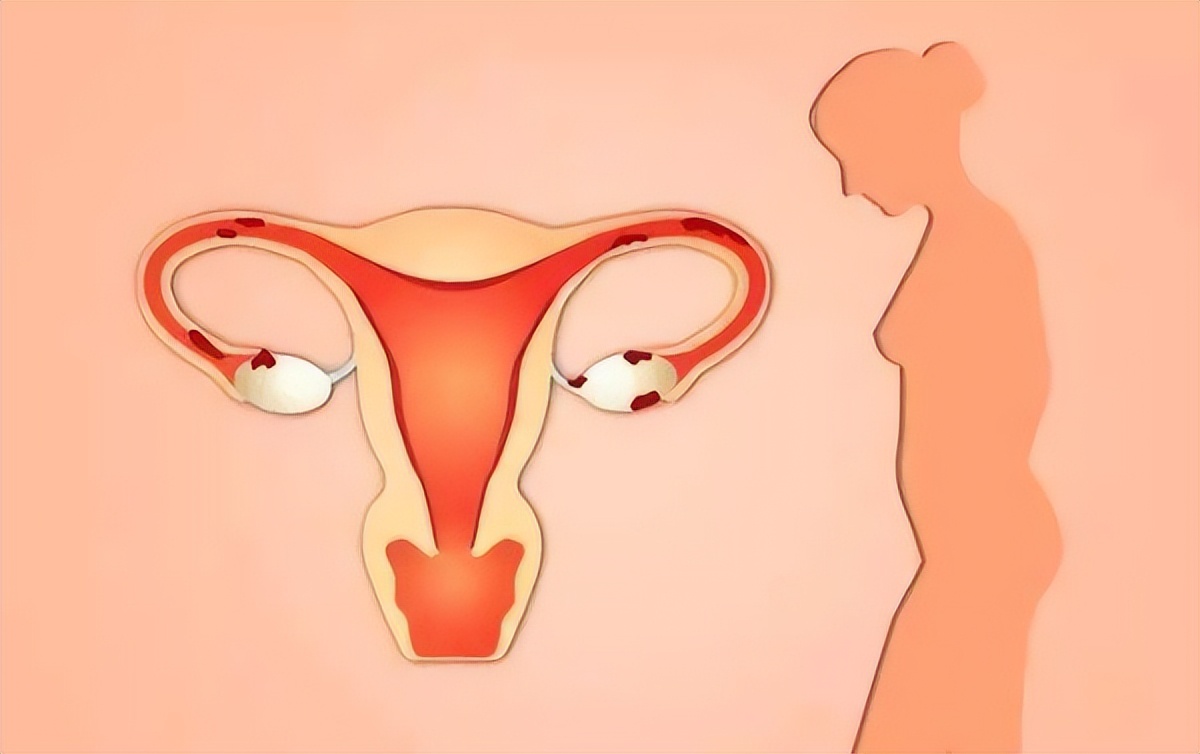 老年人绝经后倒开花的三种表现,中老年女人易得癌症类型