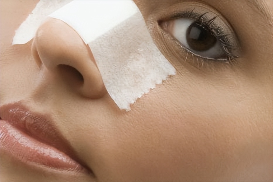 鼻子螨虫怎么去除简单方法是什么,鼻子一挤就出好多白色的螨虫