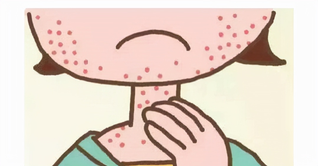 发现皮肤过敏了，做好这几步很重要