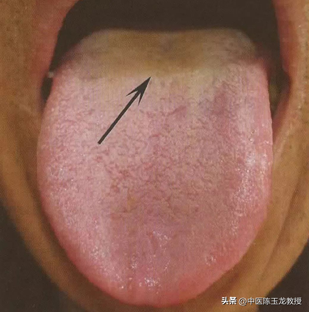 下焦湿热重、身体潮湿有异味？送你一方，清热燥湿，帮你彻底解决