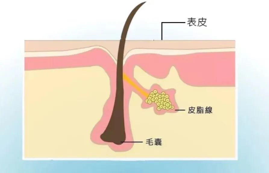 拒做油美人7招告别脸部油腻,夏日控油五步走法