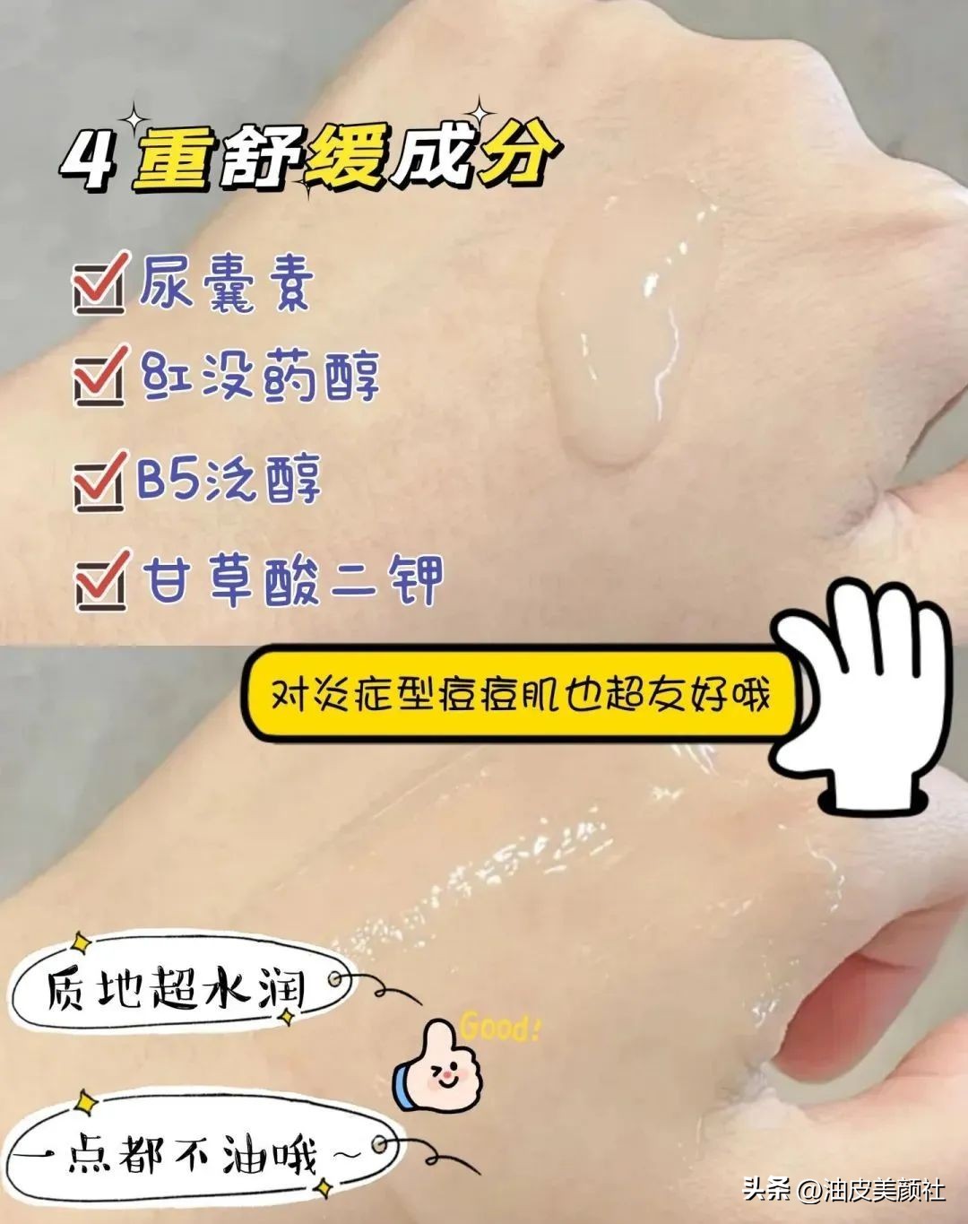 377和烟酰胺哪个美白效果更好,377和烟酰胺哪个控油