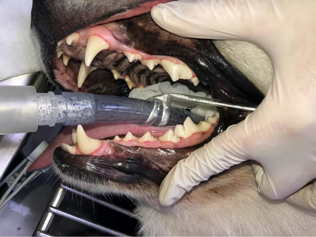 征兵体检牙釉质发育不全,牙釉质发育不全该怎么办