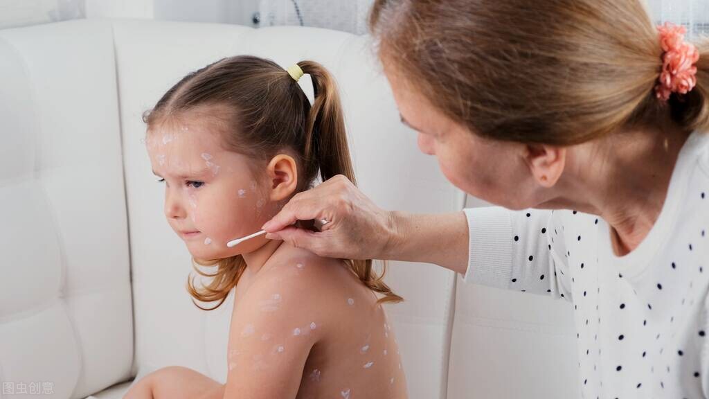 单纯疱疹与水痘带状疱疹的鉴别,水痘和单纯性疱疹有啥区别