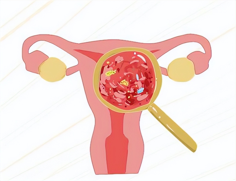 几块钱的甲硝唑可以治疗咽炎吗,几块一瓶的甲硝唑能治4种病