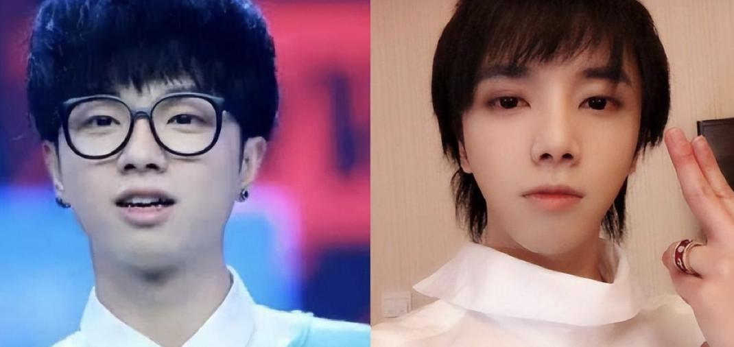 假下巴对决！谁的能戳死人，谁的下一秒就飞出去，谁的越整越残？