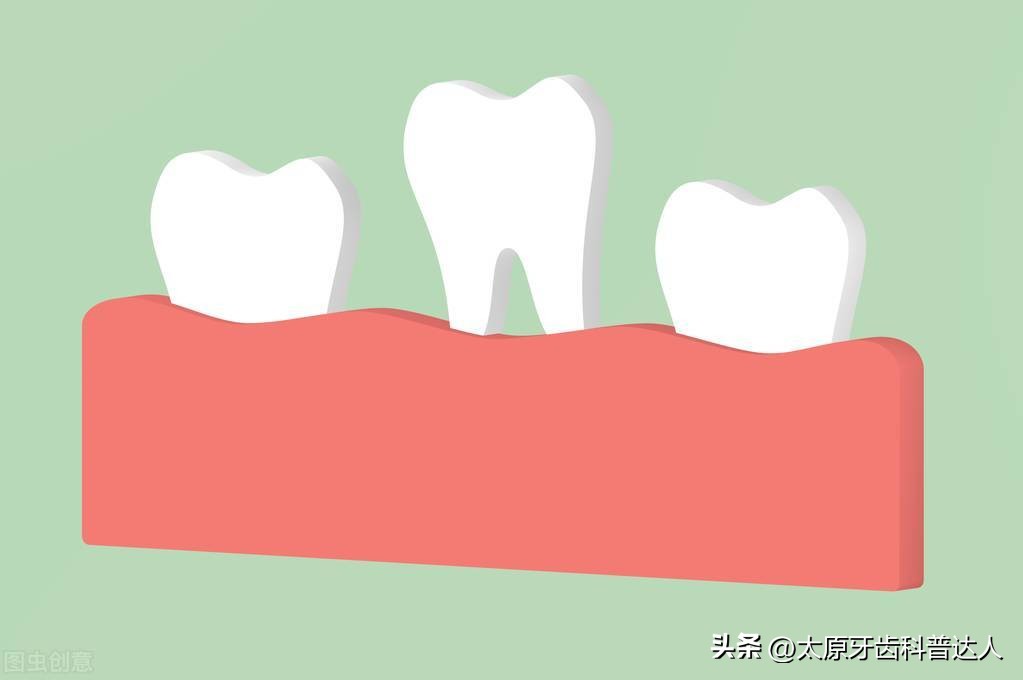 预防牙齿松动牙膏,牙周炎牙齿松动用什么方法补救呢