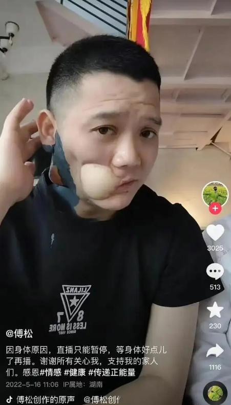 槟榔成瘾还有晕乎乎的感觉了吗,槟榔的危害有多大看完你还敢吃吗