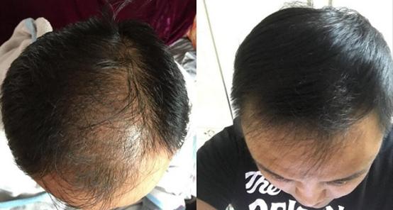 纪云颂洗发水是不是智商税,诗千娇洗发水是智商税吗