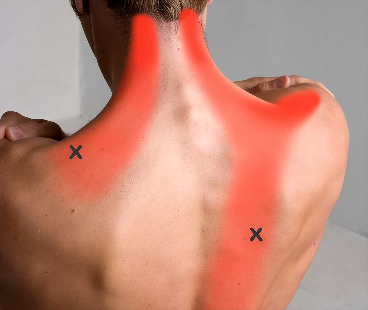 肩胛骨后背疼可能是肺癌吗,后背肩胛骨持续疼痛是肺癌吗