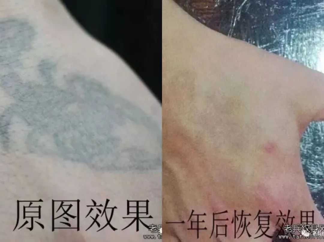 怎样洗纹身对皮肤的损伤小,不伤皮肤的洗纹身方法