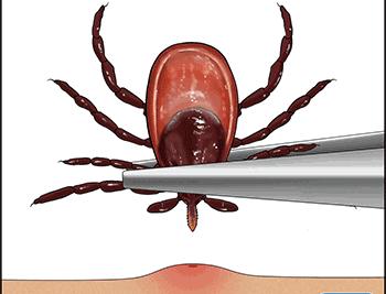 夏季常见皮肤问题医生教你,夏季皮肤瘙痒有什么方法