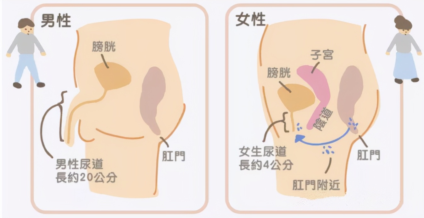 怎样治疗尿路感染和上火,上火引起尿路感染最快缓解方法