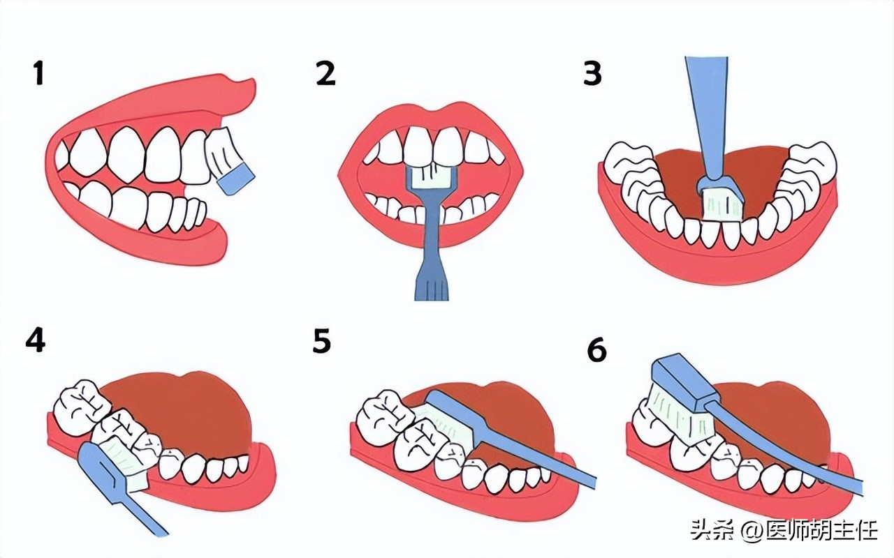 牙缝中的牙结石怎么去除,牙缝的牙结石怎么自己去除