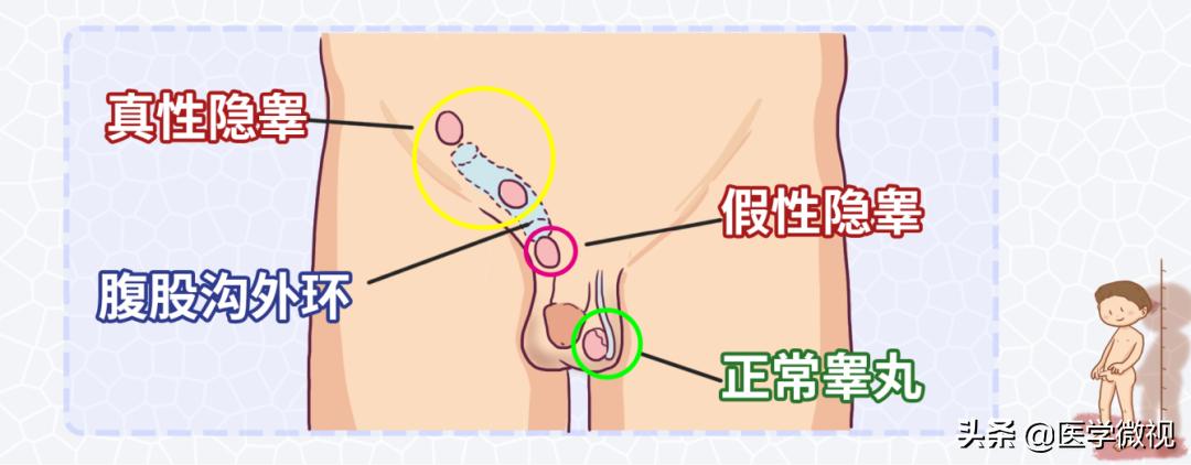 只有一个蛋蛋，或者两个蛋蛋大小不一，这都正常吗？
