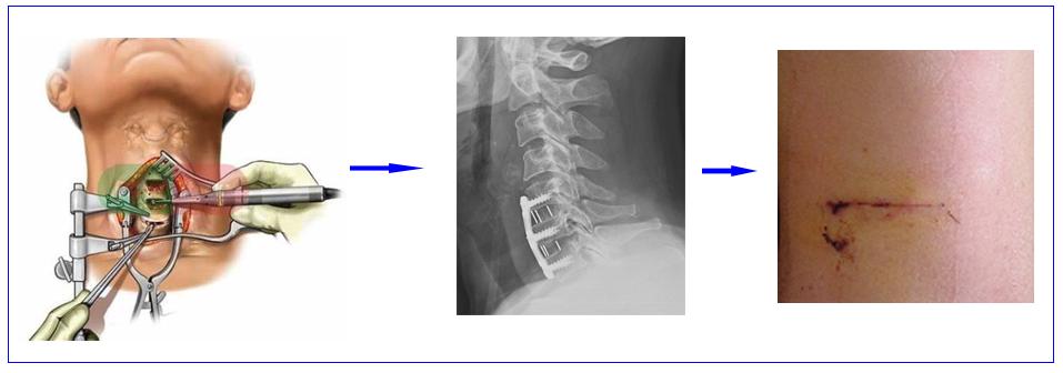 颈椎病是什么病要怎么治,颈椎病是怎样的症状