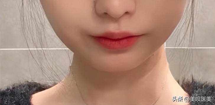女明星都逃不过的颈纹,女明星也逃不过的身材缺陷