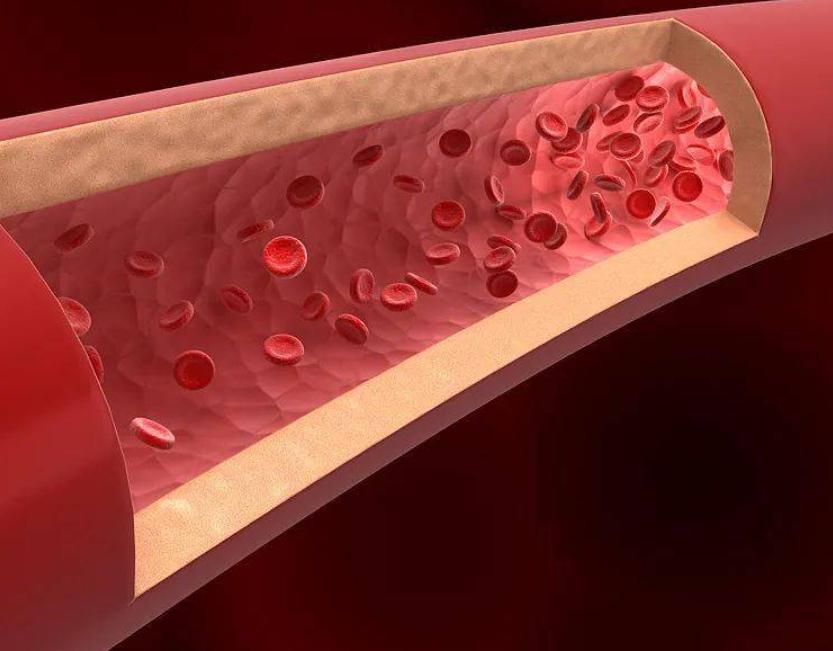 中医治疗心力衰竭效果好吗,中医对心力衰竭是如何辨证