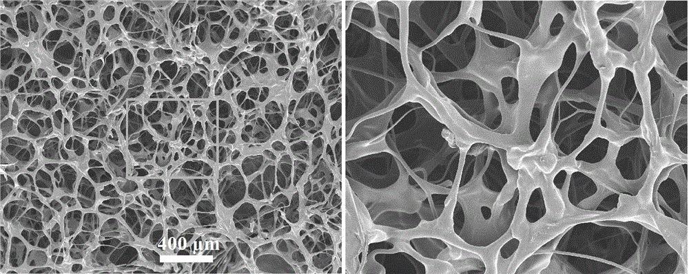 新型敷料与创面修复,创面敷料