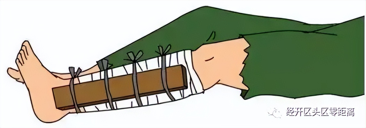 【经开·健康】安全救护“零距离”，急救知识进企业、进社区