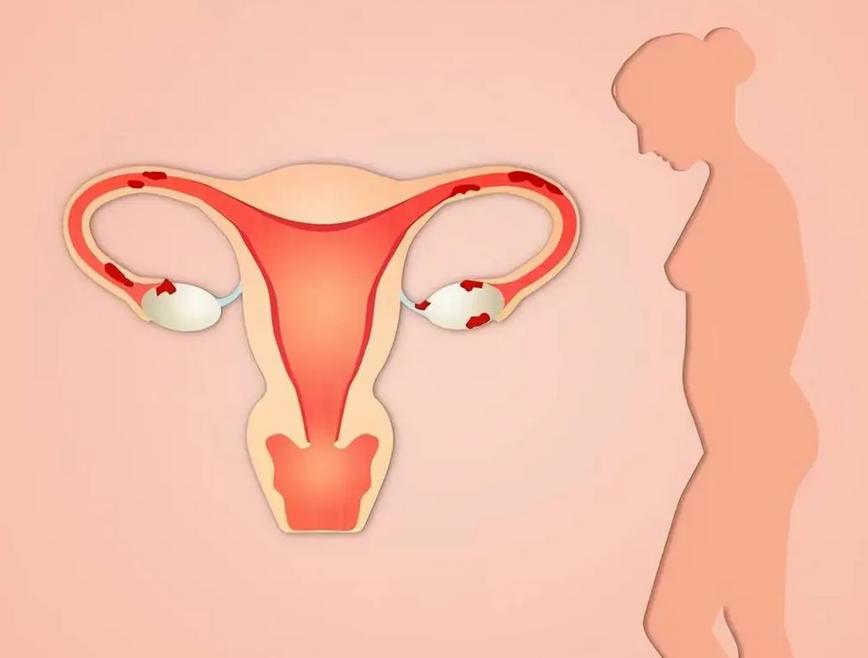 30岁的女人患上了阴道松弛，老公都不愿意碰她！怎么办？