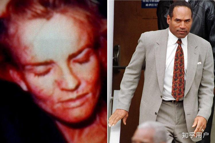 美国历史上备受瞩目的刑事案件之一——辛普森杀妻案