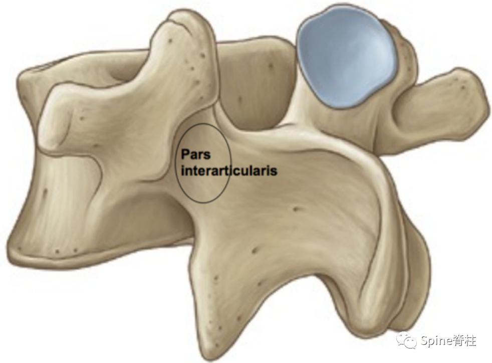轻度峡部裂和重度峡部裂的区别,真性峡部裂和假性峡部裂